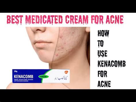 Best Medicated Cream For Acne And Pimples How To Use Kenacomb Cream