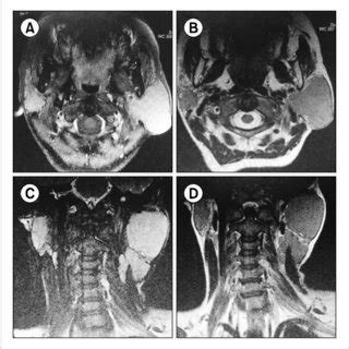 Contrast Enhanced T Weighted Axial And Coronal Magnetic Resonance