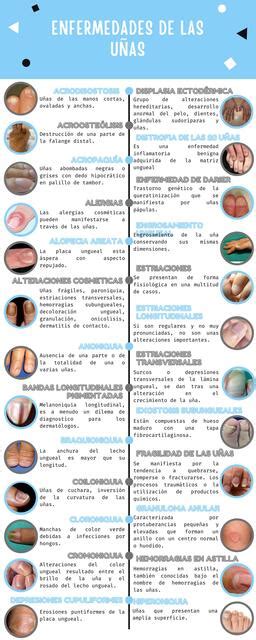 Descubrir 59 imagen imágenes de enfermedades de las uñas Viaterra mx