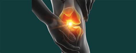 Physical Therapy For Optimal Knee Pain Management