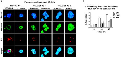 Cancers Free Full Text Selenof Controls Proliferation And Cell