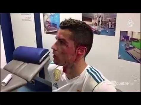 La Reacción de Cristiano Ronaldo Tras Verse Con Sangre YouTube