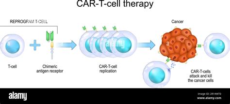 Terapia De C Lulas T Con Car Inmunoterapia Contra El C Ncer