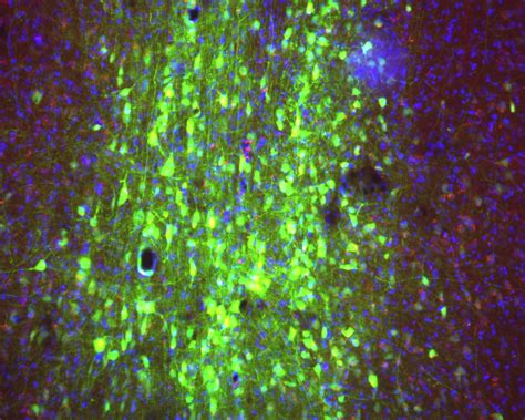 Addgene Aav Data Hub Paav Hsyn Egfp In Rat Aav