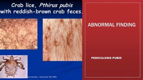 Assessing Male Genitalia And Rectum Pptx