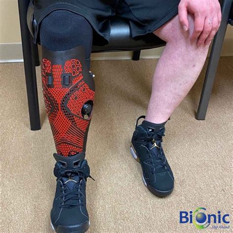 Below Knee Leg Prosthetic Below Knee Prosthetic Parts