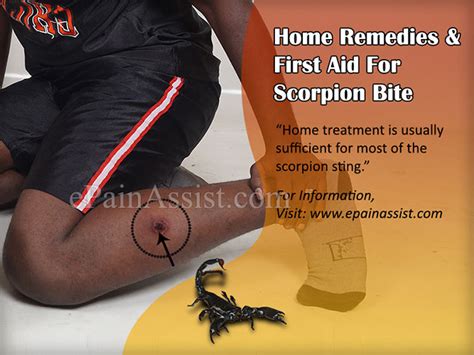 Scorpion Bite Symptoms Home Remedies First Aid Treatment