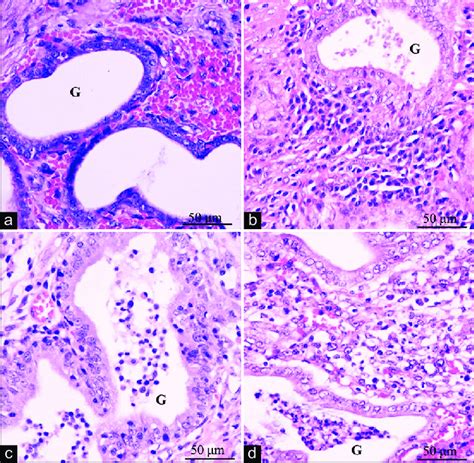 Hematoxylin And Eosin Stained Histological Images Of Transverse Uterine