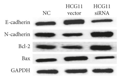 Lncrna Hcg11 Inhibits Cell Proliferation Migration And Invasion In