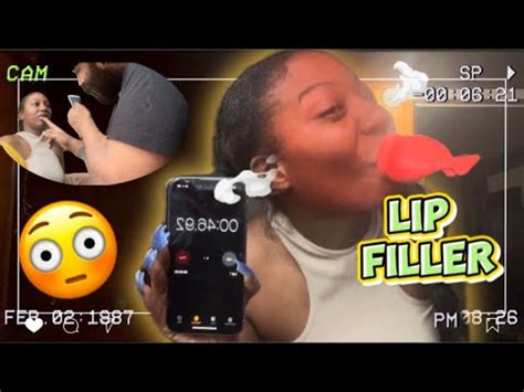 LIP FILLER PRANK ON MY HUSBAND Gone Wrong Subscribe Explore