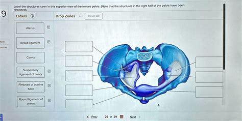 Solved Label The Structures Seen In This Superior View Of The Female