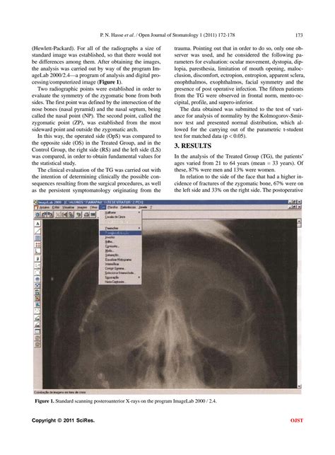 SOLUTION Clinical And Radiographic Evaluation Of Surgical Treatment Of