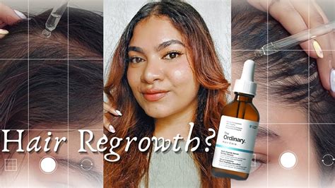 2 Months Results Of The Ordinary Multi Peptide Serum For Hair Growth Before And After Youtube