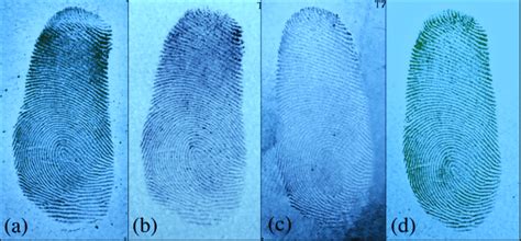 The Fingerprints In Uv Light Of Age 1 Day A 3 Days B 7 Days C