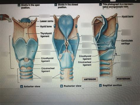 Bio Larynx Posterior View Diagram Quizlet The Best Porn Website