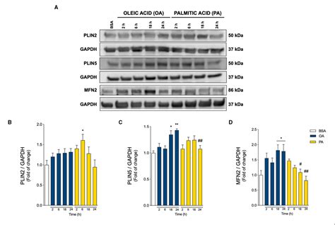 Figure 3 From Differential Effects Of Oleic And Palmitic Acids On Lipid