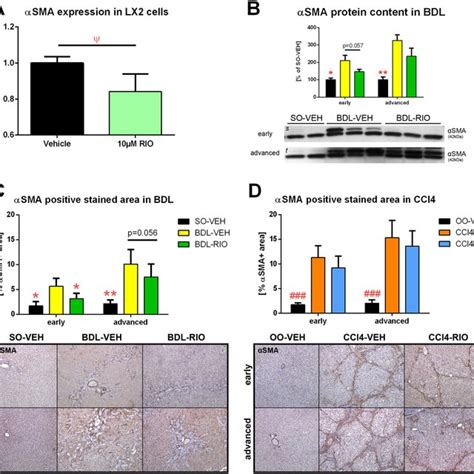 Hepatic Stellate Cell Activation In Vitro And In Vivo A Cultured Download Scientific Diagram