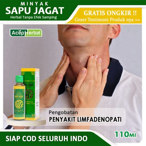 Obat Pembengkakan Kelenjar Getah Bening Penyakit Limfadenopati