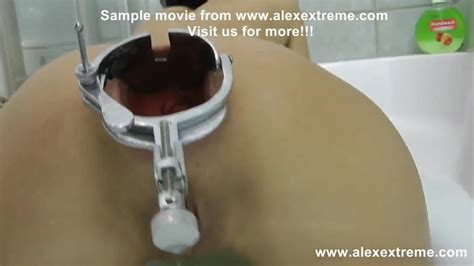 Alexextreme Anales Fisting Spekulum Prolaps Extremer Dildo XHamster