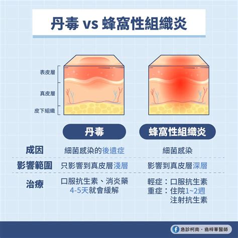 紅腫痛不一定感染，而是皮膚中毒？醫師解析：丹毒vs蜂窩性組織炎差在這