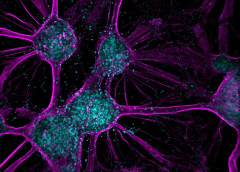 Clustered Ipsc Derived Neurons Nikon Small World