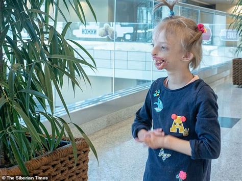 Russian girl who was born with no lips or chin flies to London for ...