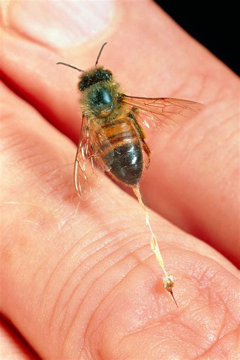 10 Tips to Avoid Getting Stung By a Bee