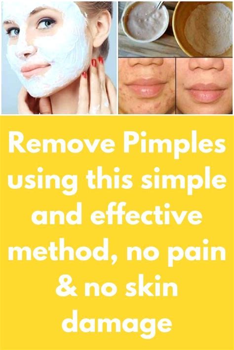 Have A Info About How To Get Rid Of Pimples Really Fast Blockbath71