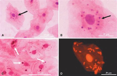 Microscopic Views Of Human Buccal Cells The Cells Were Collected By