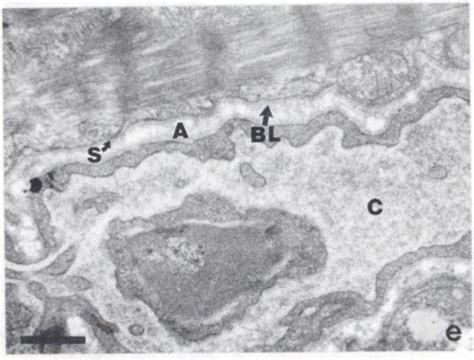 Transmission Electron Micrographs Of The Capillary Myocyte Interface Of