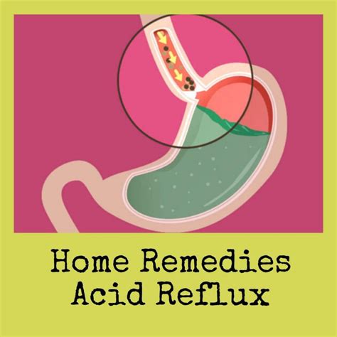 Home Remedies Acid Reflux Live To Give