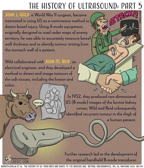 The History Of Ultrasound Part 5 And Last Ladvic Medical Ilustration