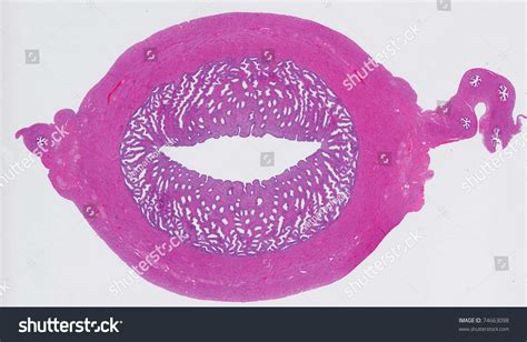 Microscopic View Of The Uterus Showing Endometrium And Myometrium Stock