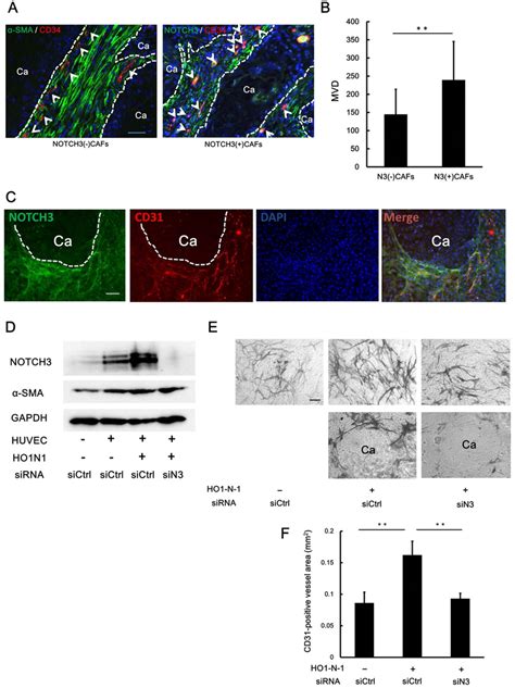 Notch3 Positive Cafs Promotes Angiogenesis A And B Comparison Of The Download Scientific