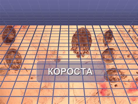 Презентація на тему «Короста» - шкільні презентації на UA-BOOKS.com.ua