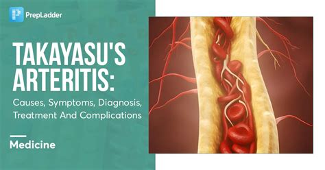 Takayasu's Arteritis: Causes, Symptoms, Diagnosis, Treatment and ...