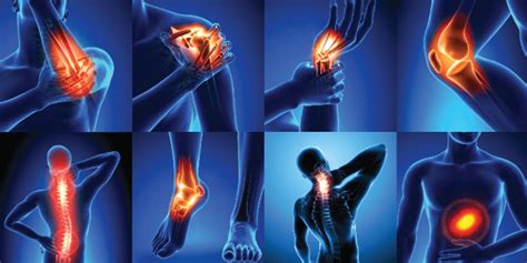 Blog | What You Need to Know About Joint Pain