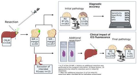 ICG Fluorescence Imaging For Real Time Margin Detection During