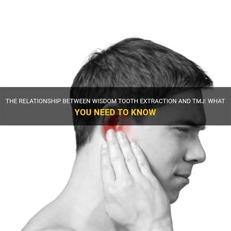 The Relationship Between Wisdom Tooth Extraction And Tmj What You Need