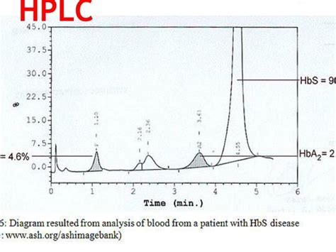 PPT - Hemoglobin Electrophoresis PowerPoint Presentation - ID:2372418