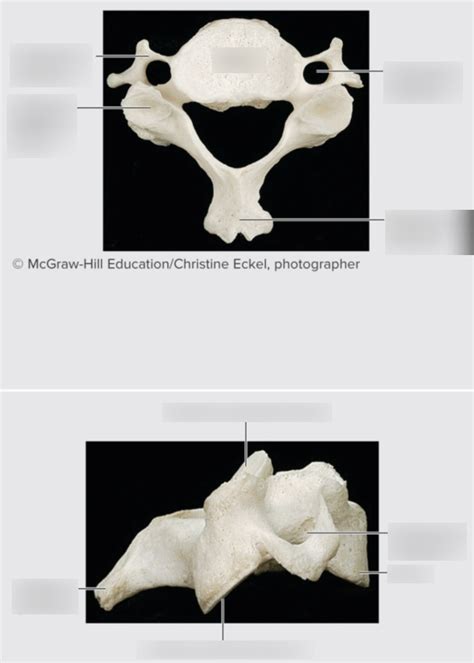 Anatomy Lab Axial Skeleton Cervical Vertebra Diagram Quizlet