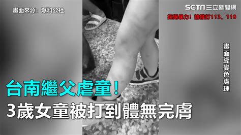 台南繼父虐童！3歲女童被打到體無完膚｜三立新聞網 Youtube