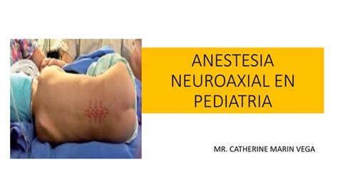 Anestesia Neuroaxial En Pediatria Ppt