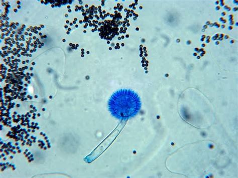 Aspergillus Junglekeyfr Image 200
