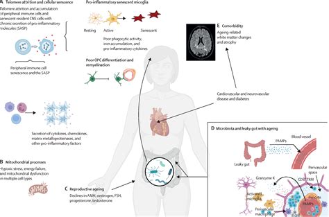 Ageing And Multiple Sclerosis The Lancet Neurology