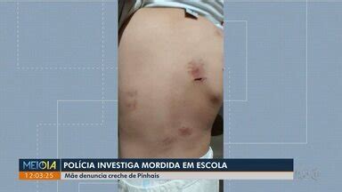 Meio Dia Paran Curitiba Pol Cia Investiga Mordidas Em Crian A Em