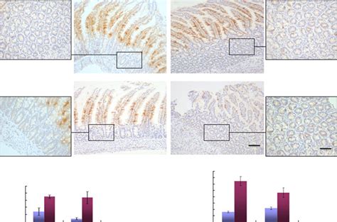 Cleaved Caspase 3 Immunostaining In The Proximal Small Intestine Of A