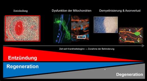 Autoimmunerkrankungen Des ZNS Karteikarten Quizlet