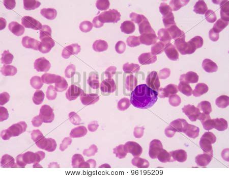 Promyelocyte Image & Photo (Free Trial) | Bigstock 