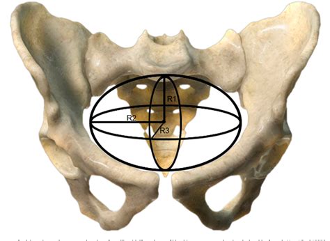 Figure 3 From Management Of Pelvic Injuries In Hemodynamically Unstable